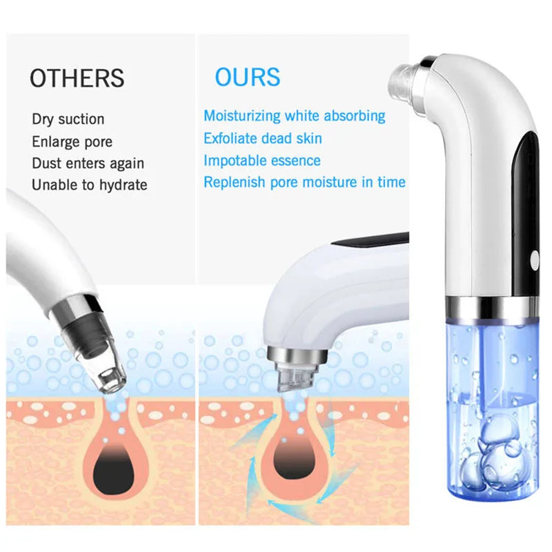 2024 Black Pore Vacuum Cleaner Electric Micro Bubble Cleanser USB Charging Beauty Instrument Skin Care Tool